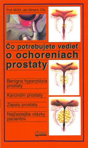 CO POTREBUJETE VEDIET O OCHORENIACH PROSTATY