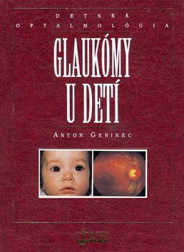 GLAUKOMY U DETI