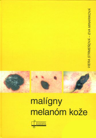 MALIGNY MELAMON KOZE