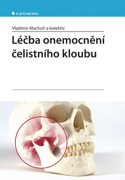 LECBA ONEMOCNENI CELISTNIHO KLOUBU