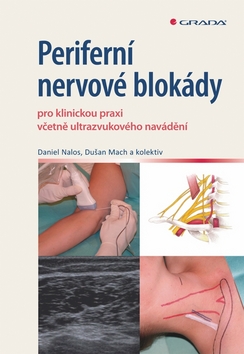 PERIFERNI NERVOVE BLOKADY