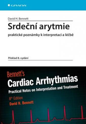 SRDECNI ARYTMIE PRAKTICKE POZNAMKY K INTERPRETACII A LECBE