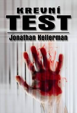 KREVNI TEST