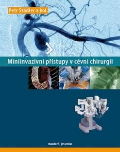 MINIINVAZIVNI PRISTUPY V CEVNI CHIRURGII