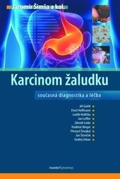 KARCINOM ZALUDKU