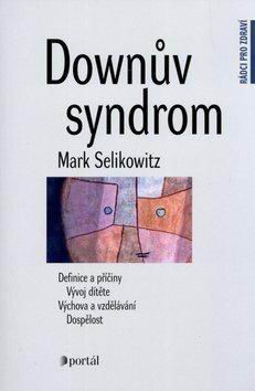 DOWNUV SYNDROM