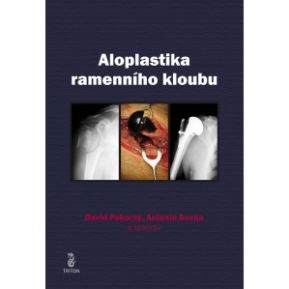 ALOPLASTIKA RAMENNIHO KLOUBU