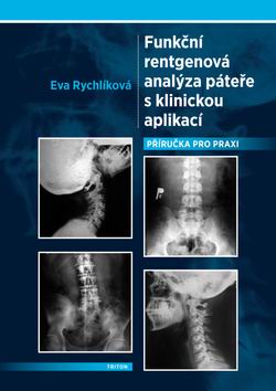FUNKCNI RENTGENOVA ANALYZA PATERE S KLINICKOU APLIKACI