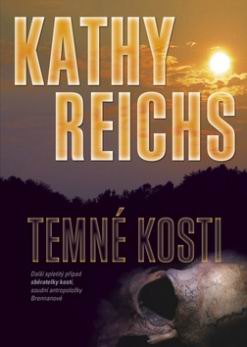 TEMNE KOSTI