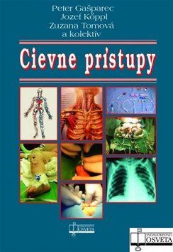 CIEVNE PRISTUPY