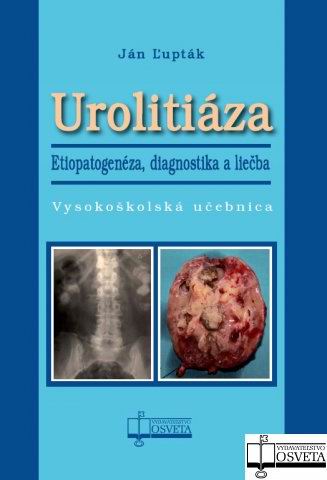 UROLITIAZA