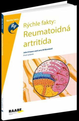 RYCHLE FAKTY: REUMATOIDNA ARTRITIDA