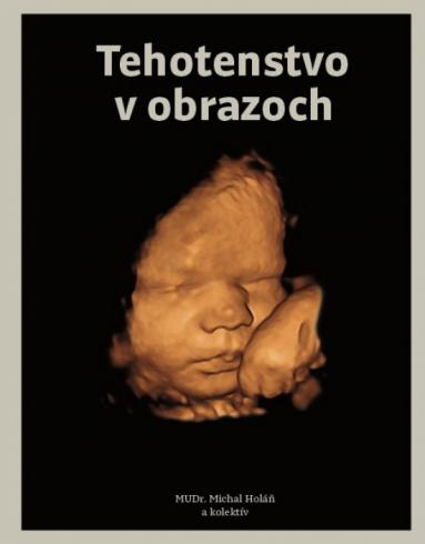 TEHOTENSTVO V OBRAZOCH