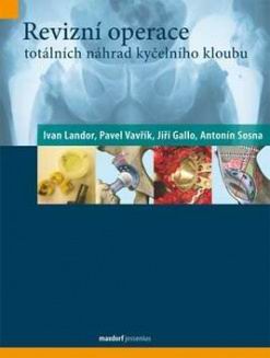 REVIZNI OPERACE TOTALNICH NAHRAD KYCELNIHO KLOUBU