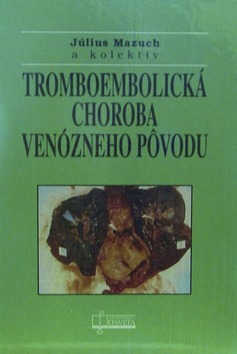 TROMBOEMBOLICKA CHOROBA VENOZNEHO POVODU