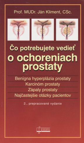 CO POTREBUJETE VEDIET O OCHORENIACH PROSTATY
